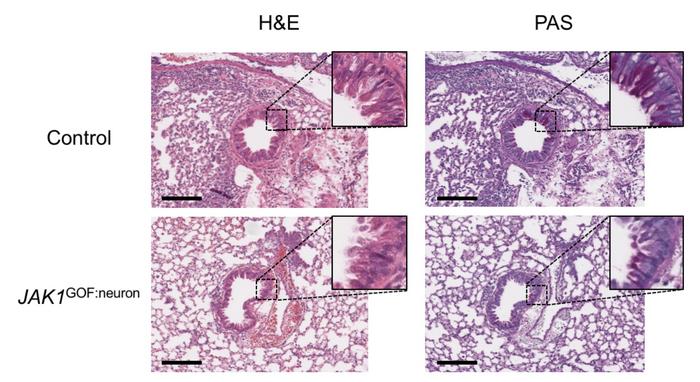 Mice engineered with a patient gene (JAK1 GOF: Neuron) show less lung inflammation, fewer immune cells, and reduced mucous production compared to controls
CREDIT: Kim et al., Cell.
